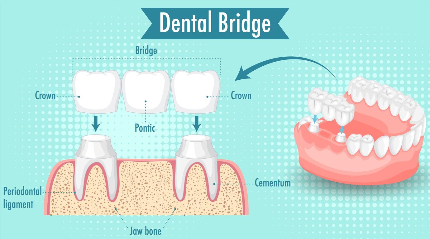 dental-clinic-in-baner